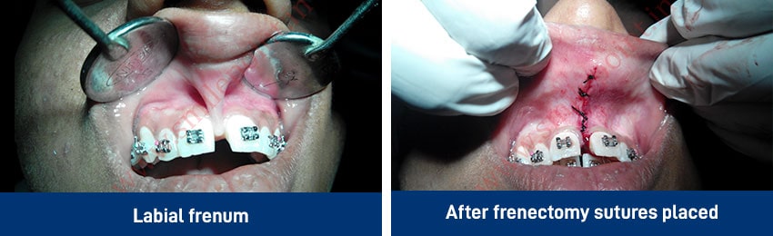 Oral Surgery